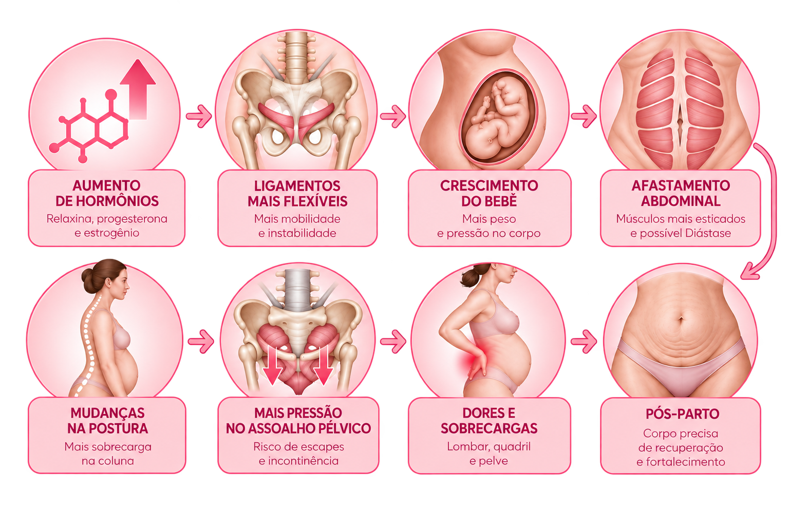 Infográfico mostrando as alterações no corpo da mulher durante a gestação: hormônios, ligamentos, parede abdominal e assoalho pélvico